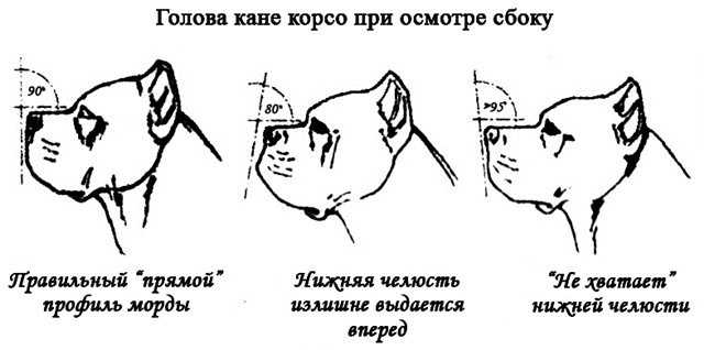 Дисплазия тазобедренного сустава