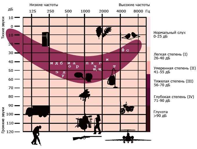  Предел слухового восприятия и ограничение децибел 