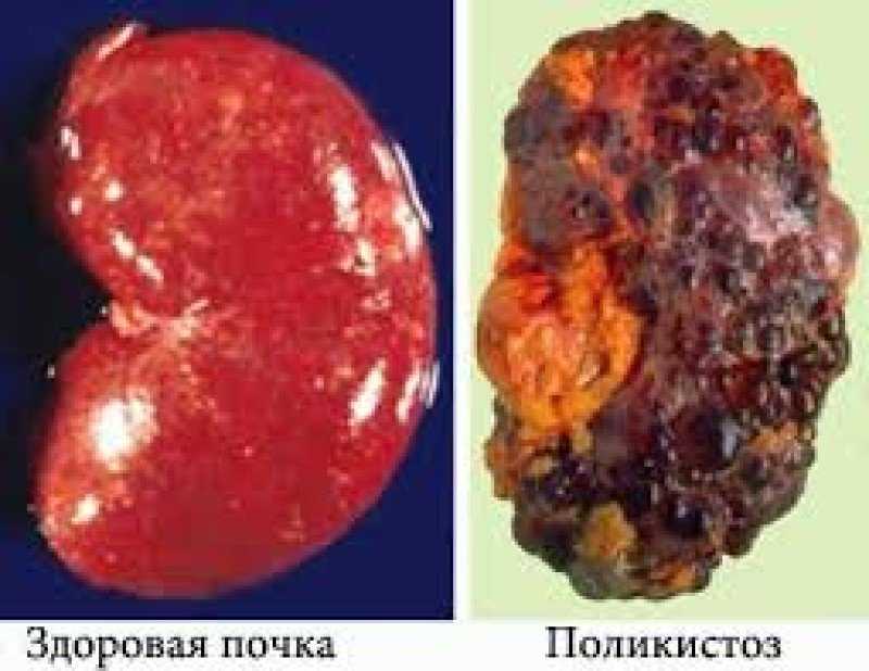 Профилактика поликистоза почек у котов